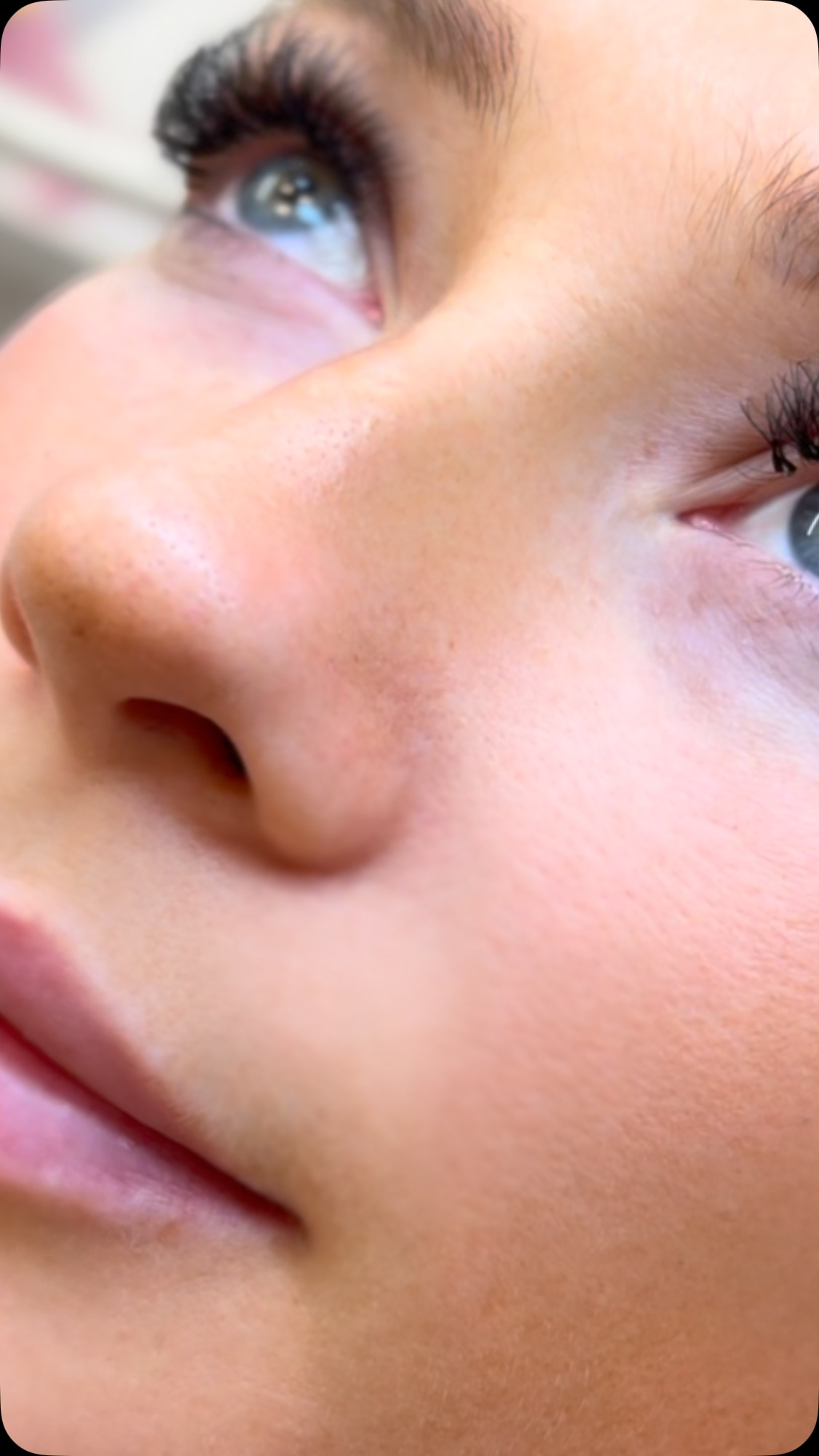 Hidralips Treatment